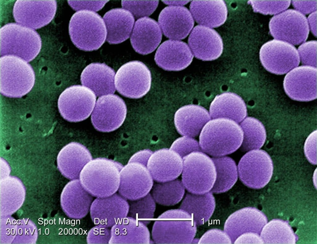 Staphylococcus aureus. The 7 Most Common Disease-Causing Bacteria