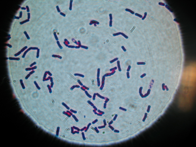 Bacillus aurues under a microscope