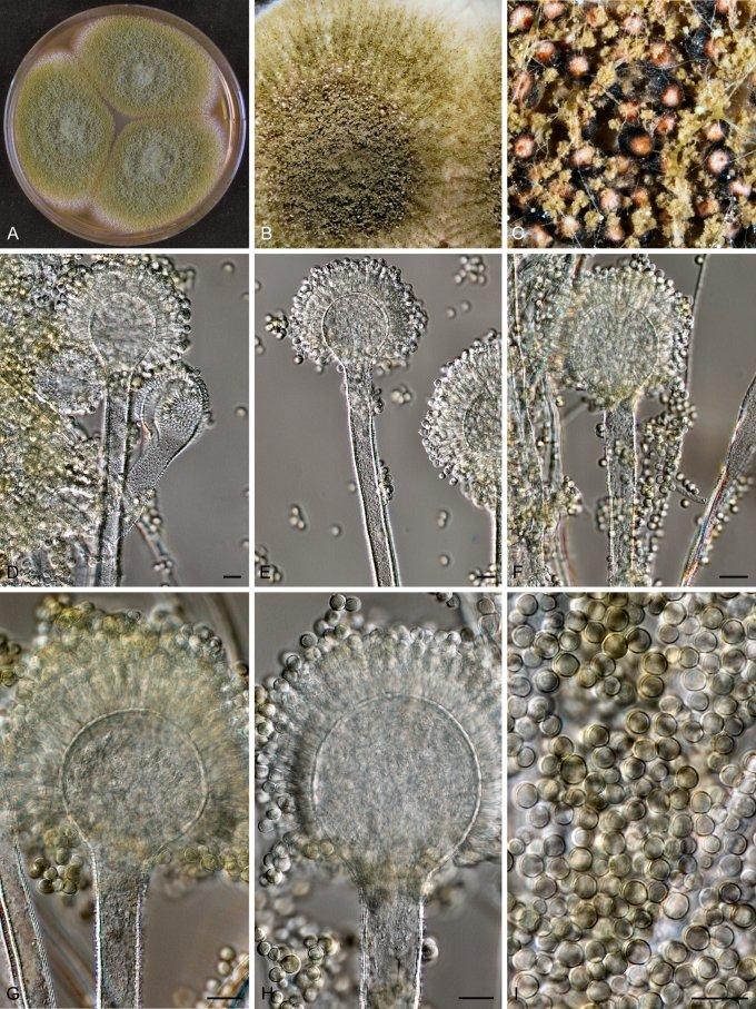 Aspergillus Oryzae under a microscope